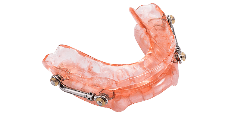 Sleep apnea oral appliance